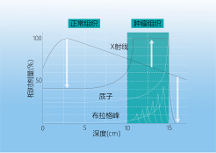 質(zhì)子治療兒童腫瘤一文詳解！